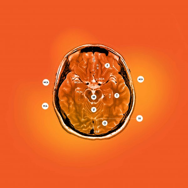 มีอะไรในสมองของคนขี้เกียจ